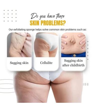 StemSpa Nanocell Exfoliating Sponge - Improve Skin Health & Reduce Cellulite (1PC) - Buy Online on GoSupps.com