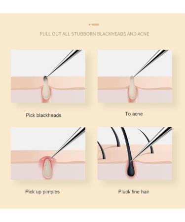 Stainless Steel Pointed Tweezers - Ingrown Hair, Blackhead & Splinter Remover - Buy Online on GoSupps.com