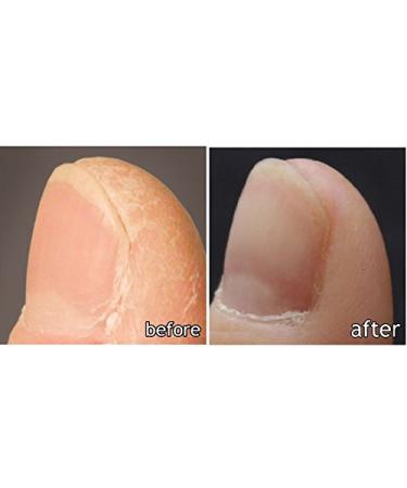 DK ELAN Silky Smooth Special Set - Ultimate Relief for Dry Rough Itchy Skin | Body Hand & Foot Care - International Shipping Available - Buy Online on GoSupps.com