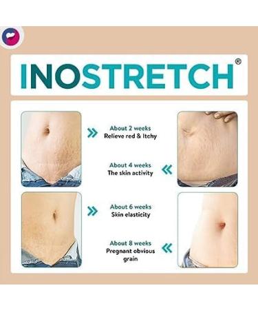 Buy I.nos tretc h Stretch Mark Cream - Reduce Stretch Marks & Scars with Natural Ingredients | 60g - International Shipping Available - Buy Online on GoSupps.com