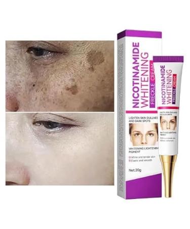 Cremas Para Las Manchas de La Cara Oscuras Para Eliminar Manchas en la Cara Crema Para Quitar Manchas de la Cara Crema Blanqueadora Para Pecas