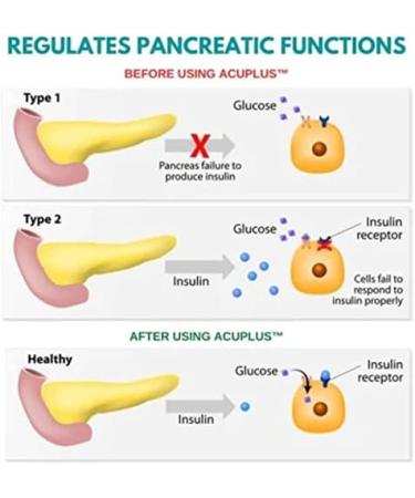 Jiaweiiy Acuplus Sugar Control Li4 Acupressure Point Clip - Tiger Mouth Thumb Massage for Optimal Hand Pressure Relief - Buy Online on GoSupps.com