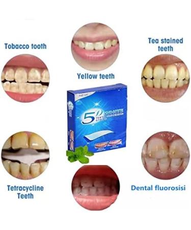 DECHOO 28 bags 56 PCS Teeth Whitening Strips 5d white teeth whitening strips White Teeth Whitening strip Tooth Help Eliminate /Smoking /Coffee/Soda - Buy Online on GoSupps.com