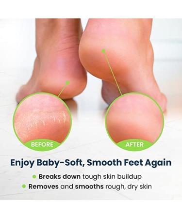 Foot Cure Exfoliator & Callus Remover Pedicure Set - Includes Foot File, Tea Tree Oil Soak, Urea Cream, USA Made - Buy Online on GoSupps.com