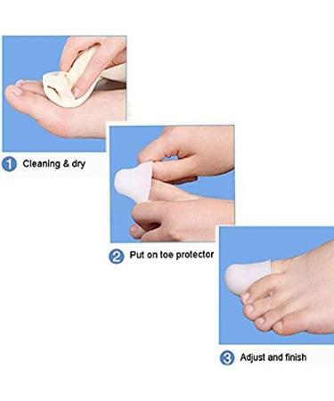 PEDIMEND Big Toe Silicone Gel Protector 2PCS - Prevent Corns, Blisters & Friction - Straightener for Ingrown Toe Nails - Unisex Foot Care Solution - Buy Online on GoSupps.com