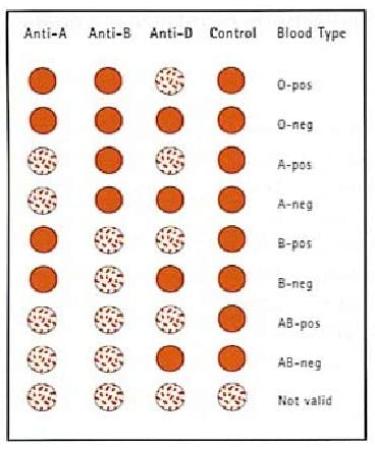 Eldoncard Blood Type Test Kit - 3 Tests | ABO AB & Rh Grouping | Includes 3 Extra Lancets - Buy Online on GoSupps.com