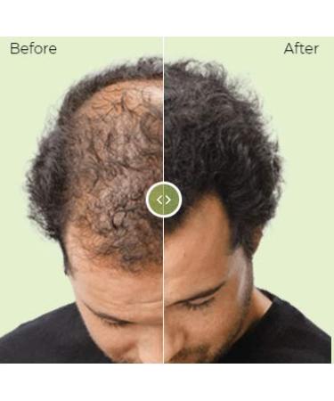 Hair Building Formula (Dark Blonde) - Enhance Your Look | Shop Now for Fast International Shipping - Buy Online on GoSupps.com