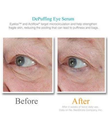 Exuviance Depuffing Eye Serum 6 ml - Reduce Puffiness & Dark Circles | International Shipping Available - Buy Online on GoSupps.com
