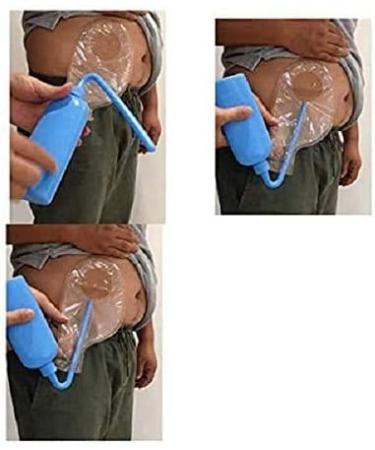 Colostomy Bag Cleaning Tool - Reusable Wash Bottle for Stoma Bag Hygiene - 1 Count - Buy Online on GoSupps.com