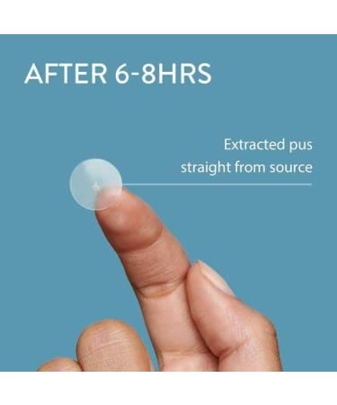 Hydrocolloid Acne Pimple Patch | 144 Fast Healing Spot Stickers for Zits & Blemishes | Vegan & Cruelty-Free Skin Care - Buy Online on GoSupps.com