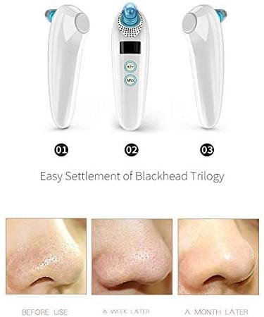 Jiklophg Electric Pimples Acne Pores Nose & Face Deep Cleaning Ice Absorption and Compression Function in - Buy Online on GoSupps.com