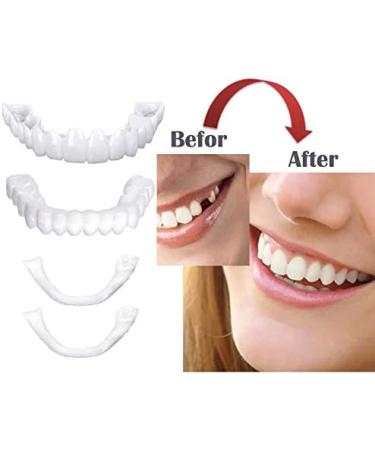 XLBHSH 3 Pair (Upper & Lower Dentures) Upper & Lower High Quality Instant Smile Comfort Dental for Men & Women for Missing Teeth with Box - Buy Online on GoSupps.com