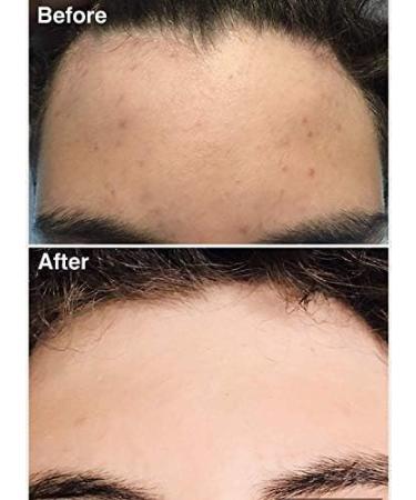 Teenology Body Wash for Teens | Acne & Breakout Prevention | Sulfate & Paraben Free | Natural Papaya Extract - Buy Online on GoSupps.com