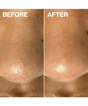 DERMAFLASH DERMAPORE Ultrasonic 2-in-1 Pore Extractor & Serum Infuser Tool - Icy Pink - Buy Online on GoSupps.com