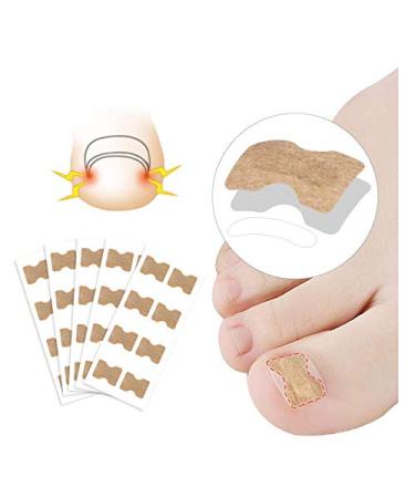 50PC Glue Free Toenail Patch - Ingrown Toenail Tools Kit Premium Nail Treatment Foot Tool,Ingrown Toenail Removal Correction Patch Professional Pedicure Tools Keep Nails Healthy & Relieve Pain (50PC) 50 Count (Pack of 1)