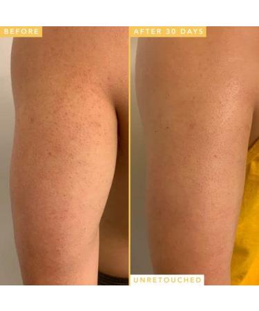 Farmacy Honeymoon Glow Body Serum - AHA and BHA with Hyaluronic Acid for Dry Skin - Buy Online on GoSupps.com