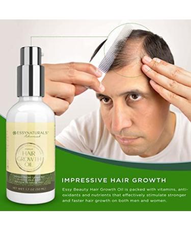 HealPool Hair Growth Oil & Scalp Massager Brush for Thicker, Stronger Hair - Men & Women - Buy Online on GoSupps.com
