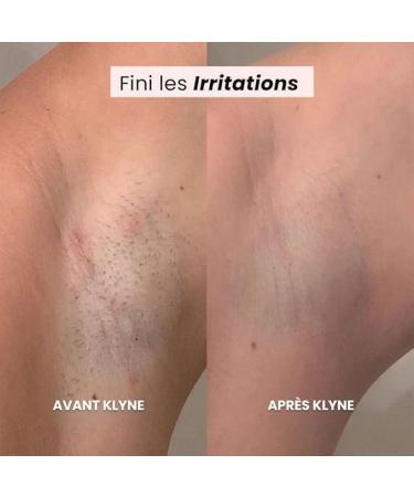 Rasoir lectrique Femme Tondeuse Femmes 2 en 1 Dual Head Shaver Women Sans douleur Tondeuse Intime pour Femme Rasoir tanche pour Visage Aisselles Jambes Utilisation Humide et S che (Bleu) - Buy Online on GoSupps.com