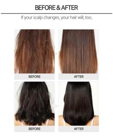 CP-1 Ginger Purifying Conditioner 100 ml Conditioner Resolve Nutritional Deficiencies Tired Hair Treatment Ginger Oil Improves Makes Hair Healthy and Shiny - Buy Online on GoSupps.com