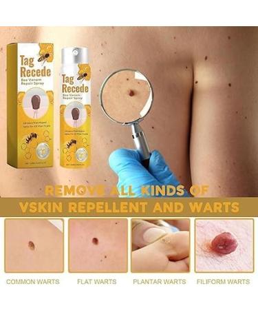 (100% Effective) Tag Recede Bee Venom Tag Recede Bee Venom Spray - Buy Online on GoSupps.com