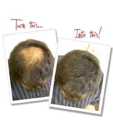 Hair Loss Concealer - Light Brown Hair Building Fibers 23g | Best Hair Thickening Solution for Men & Women - Buy Online on GoSupps.com