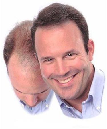 Tala Snake Oil (Tala Yilan Ya) Organic Hair Growth - Natural Solution for Hair Growth - Buy Online on GoSupps.com