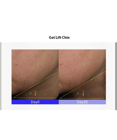 1PC John Jeff Peptide Serum Firming Lifting Soothing Fine Lines Balancing Facial Serum Essence Firming Skin Serum Ampoule 30ml - Buy Online on GoSupps.com