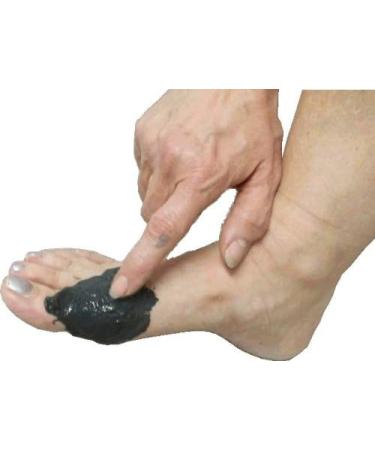 Sivash Healing Medical Device - 1kg Salvation Sludge for Joints & Skin Relief | Arthritis Gout Acne & Psoriasis Treatment - International Shipping - Buy Online on GoSupps.com