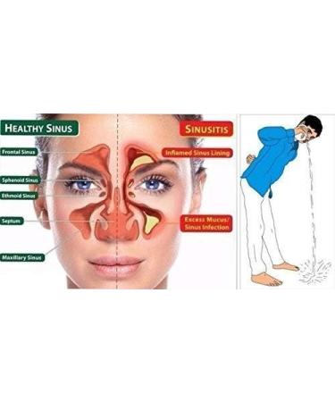 Buy 304 Grade Stainless Steel Ayurvedic Jal Neti Pot | Sinus Congestion Relief & Nasal Cleansing | 500mL with Rubber Neti & Eye Wash Cup - International Shipping Available - Buy Online on GoSupps.com