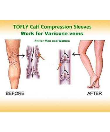 TOFLY Calf Compression Sleeve 20-30mmHg for Men & Women - Footless Compression Socks for Leg Support, Shin Splint, Pain Relief, Varicose Veins - 1 Pair (Beige, Size S-5XL) - Buy Online on GoSupps.com