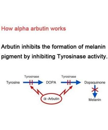 First Lady Fast Actives Original Skin Lightening & Exfoliating Soap 200g (Red) - Buy Online on GoSupps.com