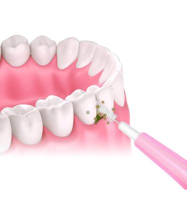 Buy 0.6 1.5 mm Interdental Brush Set - Essential Toothpick Tools for Effective Dental Care | International Shipping Available - Buy Online on GoSupps.com