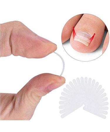 Ingrown Toenail Correction Kit - Toenail Treatment & Straightening Patch for Effective Foot Care - Buy Online on GoSupps.com