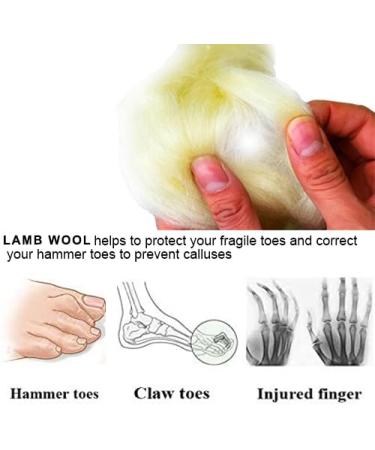 Lamb's Wool Toe Cushioning Pads - Soft Toe Separators for Blister Prevention & Comfort | Ideal for Hiking & Pointe Shoes - Buy Online on GoSupps.com