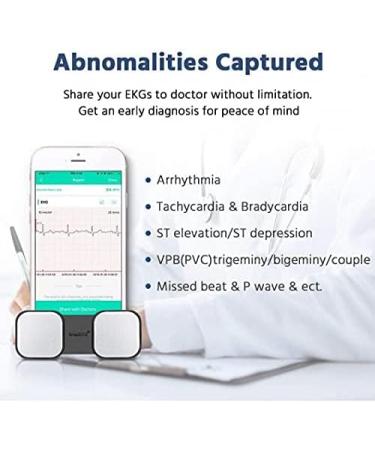 ECG Monitor Handheld ECG Heart Rate Monitors for Smart Phone Wireless Heart Rhythm Tracking Without ECG Electrodes Required Home Use SnapECG Portable EKG Devices for iPhone & Android - Buy Online on GoSupps.com