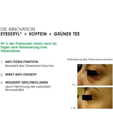 BioMD BioMD Eye Bags Away Eye Serum 15 ml - Buy Online on GoSupps.com