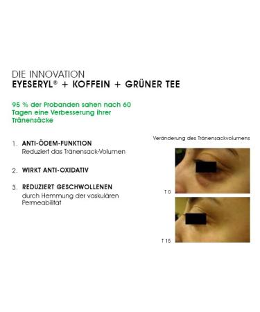 BioMD Eye Bags Away Cream - Reduces Puffiness & Dark Circles 15 ml | Fast International Shipping - Buy Online on GoSupps.com