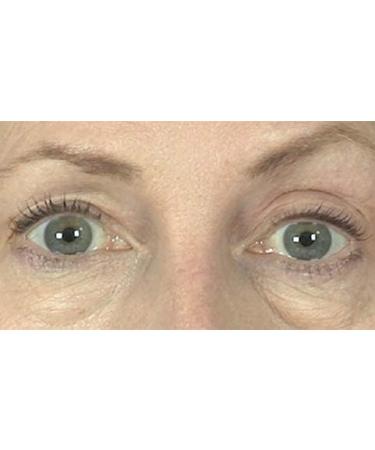 Butterfly Invisible Double Eye Lift - Instant Eye Lift Adhesive Strips - Buy Online on GoSupps.com