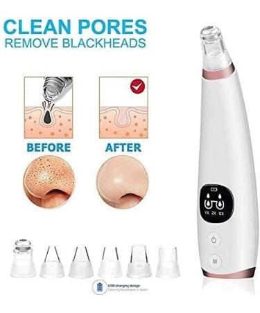 SMSOM Blackhead Remover Vacuum Portable Electric BlackheadRemoval Tools Pore Cleaner Extractor Facial Cleaner 6 Replacement Probes USB Rechargeable (Black) - Buy Online on GoSupps.com