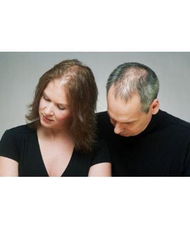 Hair So Real Hair Building Fibres 28g - Medium Brown | Instantly Thicker & Fuller Hair - Buy Online on GoSupps.com