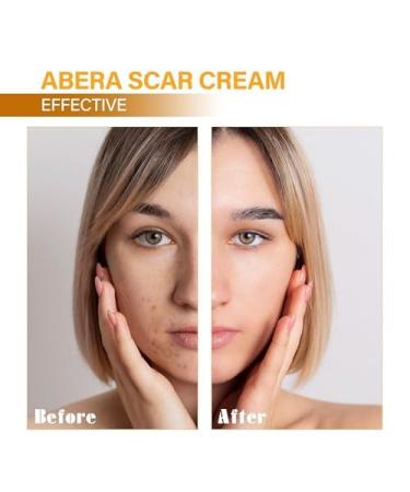 Combo Abera Scar Removal Cream - Advanced Premium Overnight Plumping Treatment for Face and Body with Natural Ingredients - Rapidly Removes Stretch Marks Keloids Burns and More (Buy 4 Get 1) - Buy Online on GoSupps.com