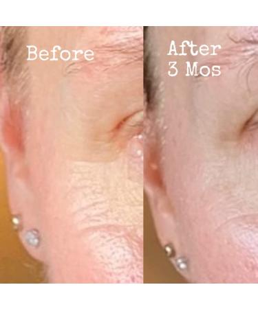 Peptide Eye & Lip Complex - .05 oz - Buy Online on GoSupps.com