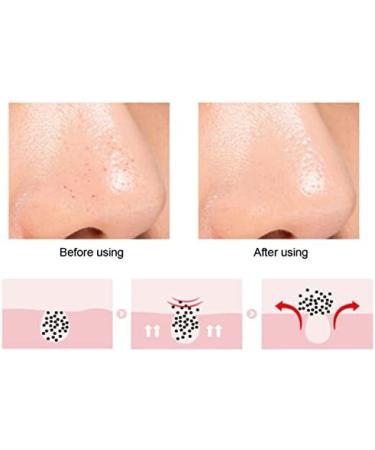 Silicone Nose & Lip Cleansing Brush - Double Sided Facial Exfoliator for Blackhead Removal & Moisturizing - Green - Buy Online on GoSupps.com