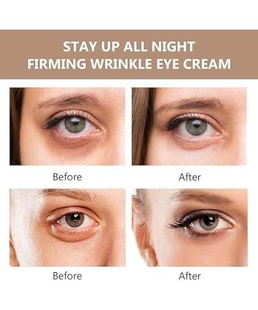 Celyn Eye Cream Set: Instant Firming, Tightening & Moisturizing Formula (2PCS) - Buy Online on GoSupps.com