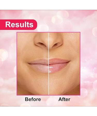 0.82oz Lip Balm For Dark Lips | Pigmentation | Dry & Chapped Lips | Men & Women (8 Gm) - Buy Online on GoSupps.com