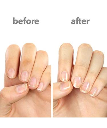 Ella+Mila Nail Strengthener & Quick Dry Top Coat Bundle - First Aid Kiss & In a Rush Polish Set - Buy Online on GoSupps.com