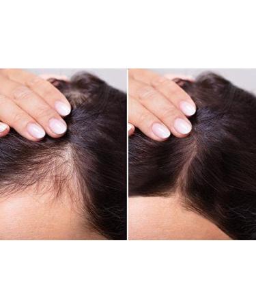 SkinLabo Hair Rinse Serum Toning & Revitalizing Lotion for Hair Loss | 50ml - International Shipping - Buy Online on GoSupps.com