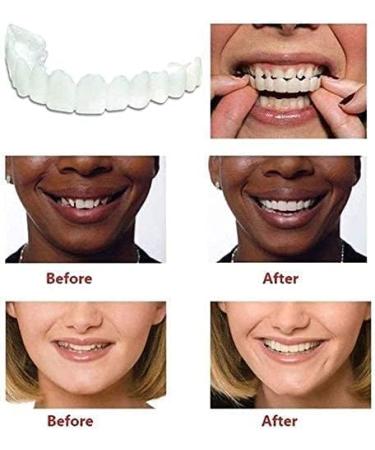 Giural 2 Pair Upper & Lower Teeth Veneer Covers - Comfortable Oral Whitening False Teeth for Men & Women - Buy Online on GoSupps.com