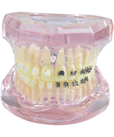 LBYLYH Pink Teeth Model - Orthodontic Dental Studio Educational Toy for Kids - Buy Online on GoSupps.com