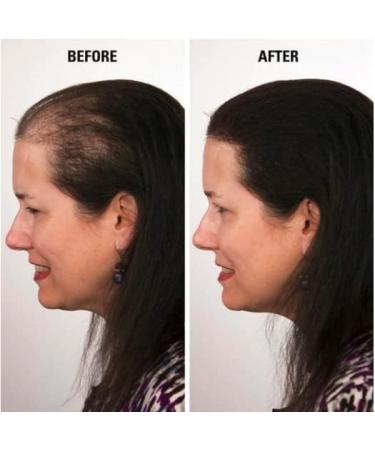 Hair Fibres x2 VOLUMON Keratin Hair Building Fibres for Thinning Hair - Instantly Conceals Thinning Areas for Fuller Thicker Hair - For Men & Women 28g x2 (Medium Brown) - Buy Online on GoSupps.com